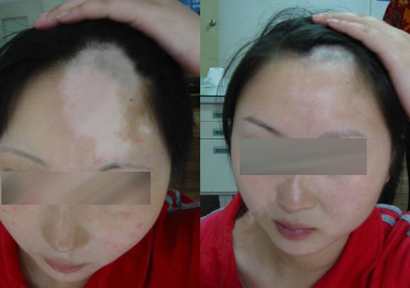 重庆皮肤病医院,重庆皮肤病医院哪家好_排名_怎么样_地址电话