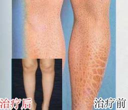 重庆皮肤病医院,重庆皮肤病医院哪家好_排名_怎么样_地址电话