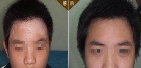 重庆皮肤病医院,重庆皮肤病医院哪家好_排名_怎么样_地址电话