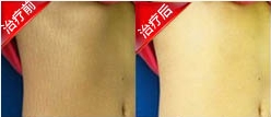 重庆皮肤病医院,重庆皮肤病医院哪家好_排名_怎么样_地址电话