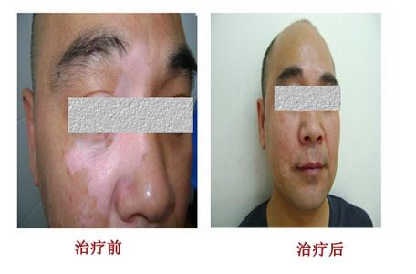 重庆皮肤病医院,重庆皮肤病医院哪家好_排名_怎么样_地址电话